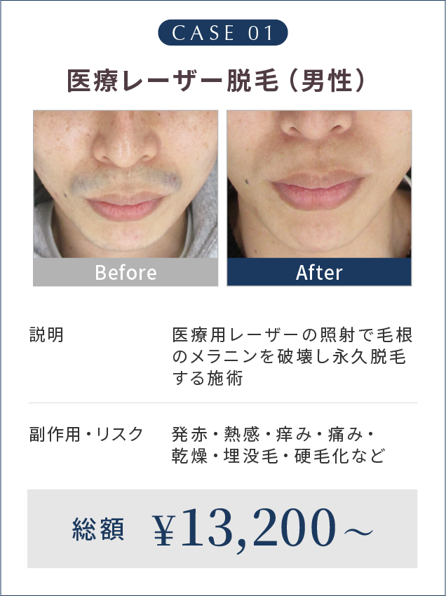 CASE 01