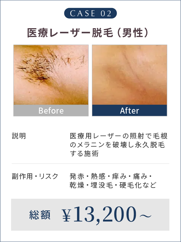 CASE 02