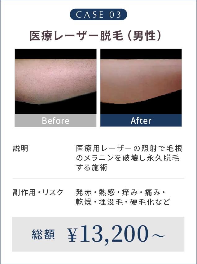 CASE 03