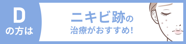 【医療従事者監修】黄ニキビ（嚢胞ニキビ）とは？原因や対処法まで詳しく解説 | ニキビ、ニキビ跡、赤ら顔の改善なら渋谷美容外科クリニック
