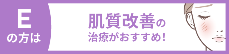 【医療従事者監修】黄ニキビ（嚢胞ニキビ）とは？原因や対処法まで詳しく解説 | ニキビ、ニキビ跡、赤ら顔の改善なら渋谷美容外科クリニック