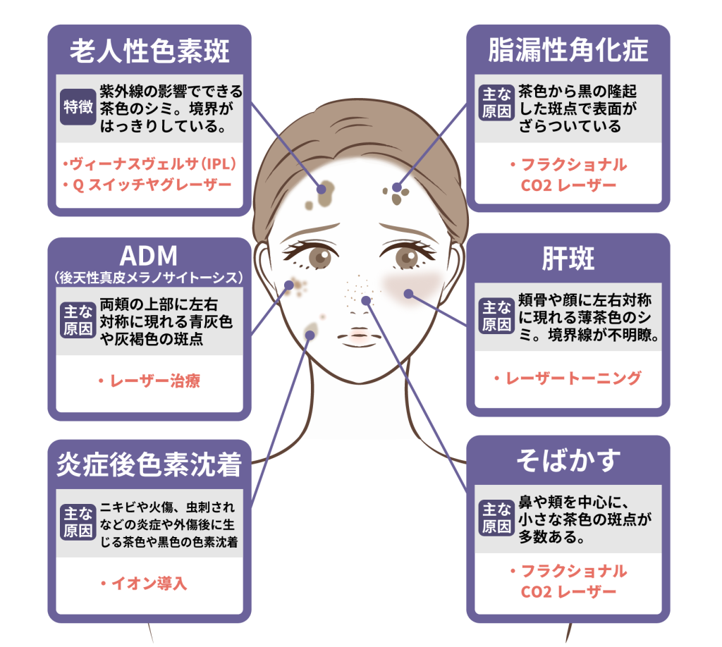 顔 の シミ 取り 方法
