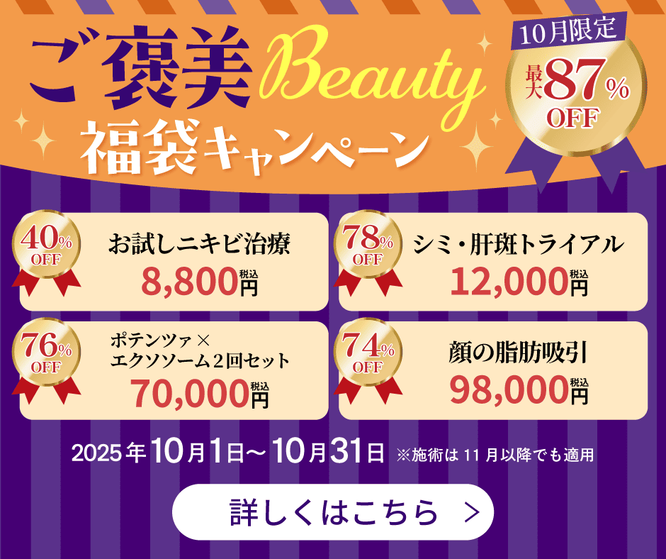 ポップアップバナー