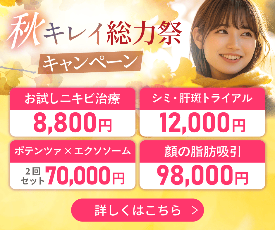 ポップアップバナー