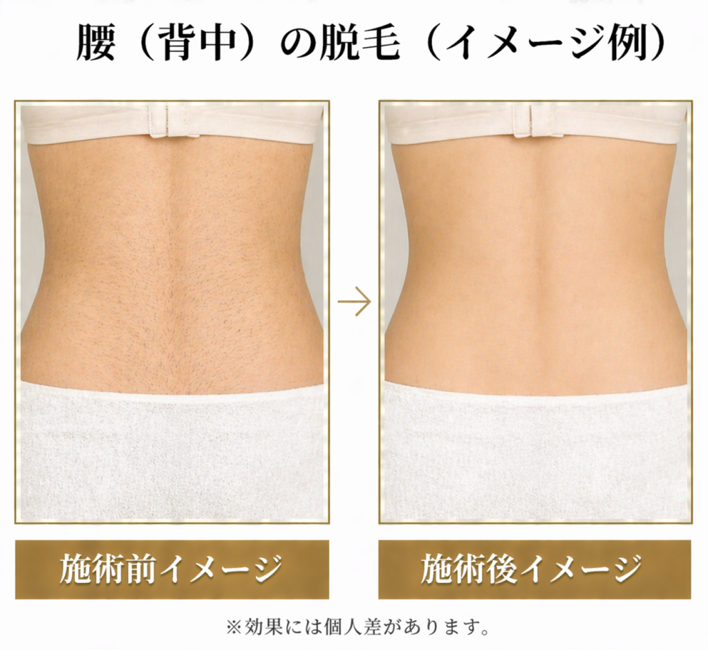 背中 脱毛 終わら ない