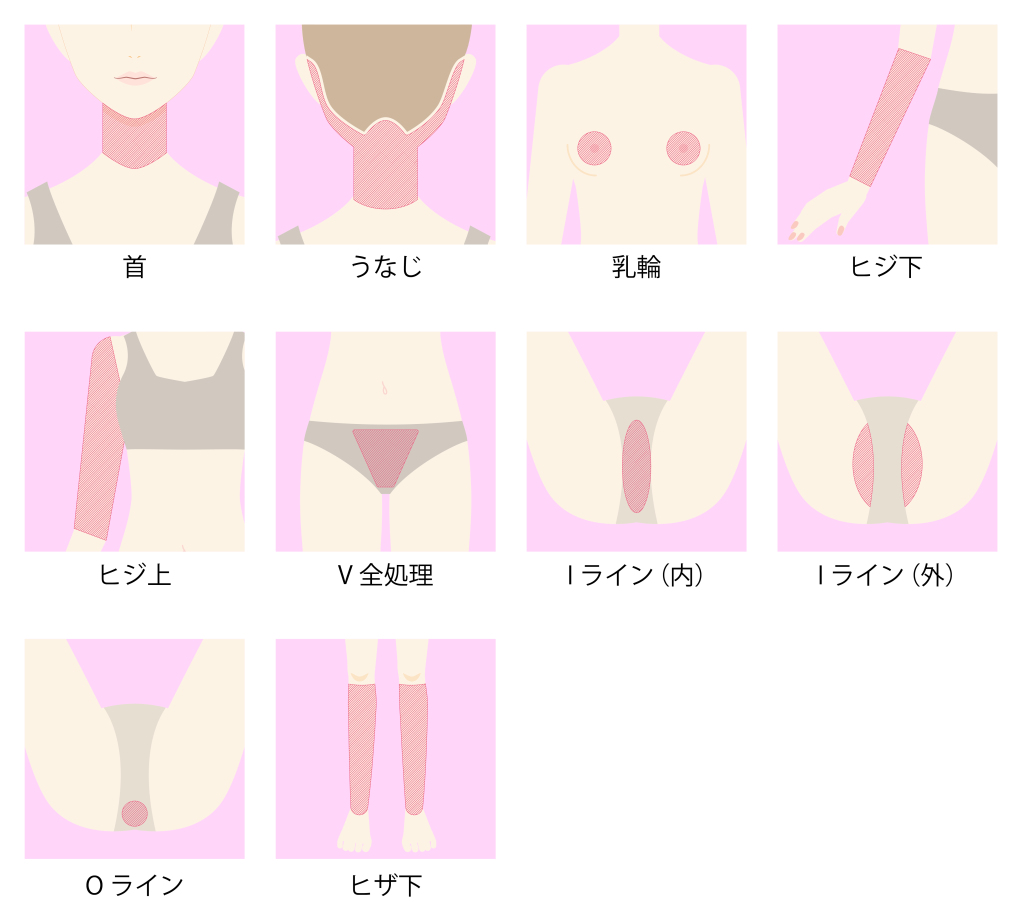 i ライン 脱毛